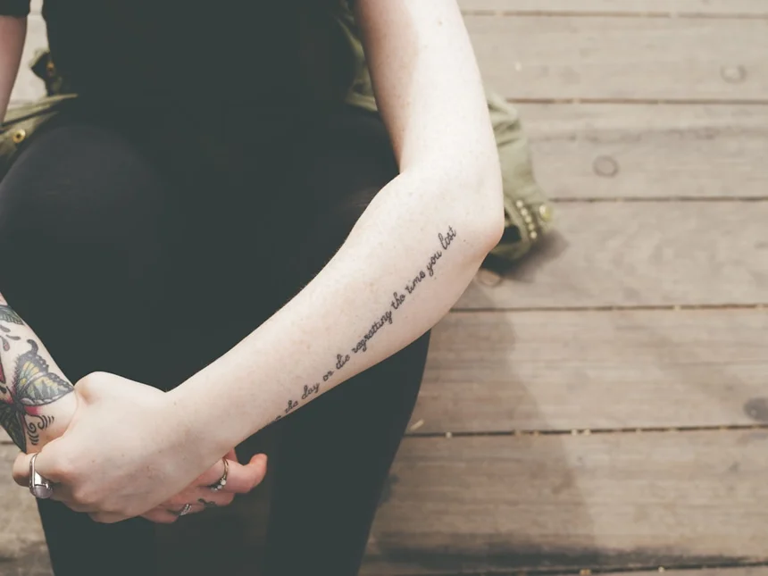 Arm