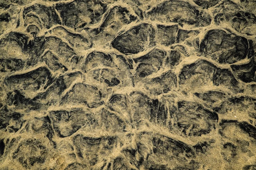 Cellulite