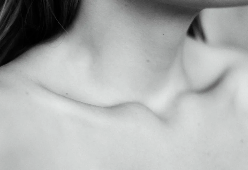 Hypothyroidism